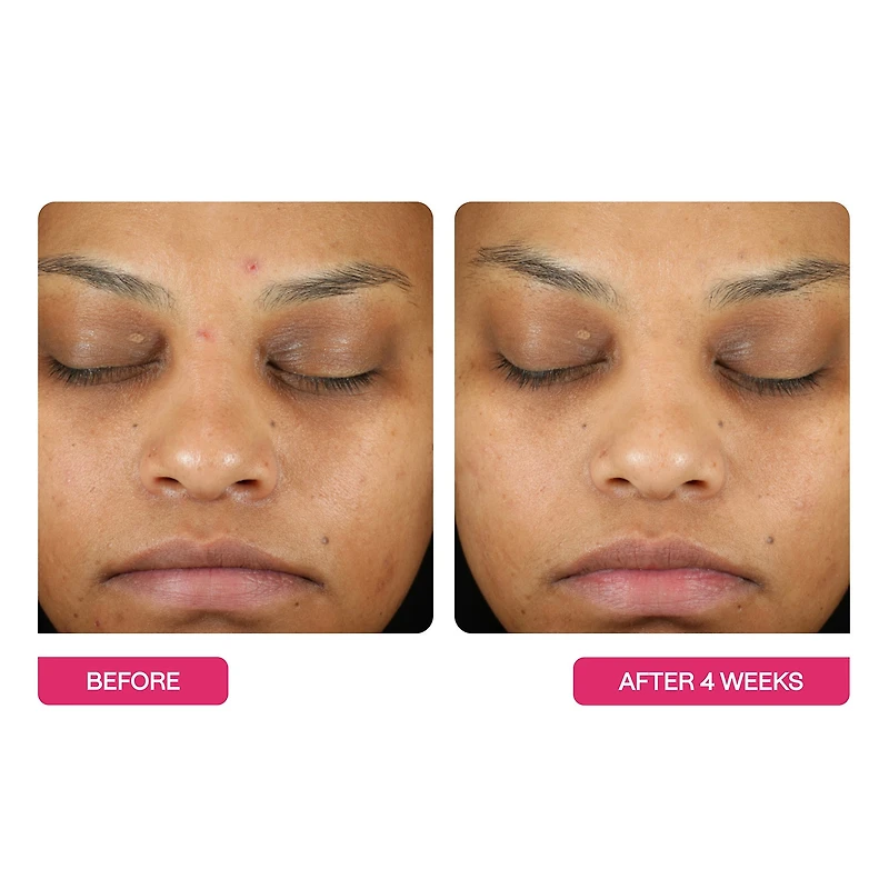 BeautyStat Universal Triple Action Peel Pads 10 Pack