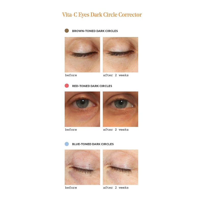 Murad Vita C Dark Circle Corrector Eye Cream