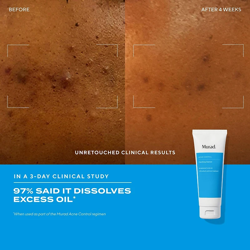 Murad Acne Control Clarifying Cleanser