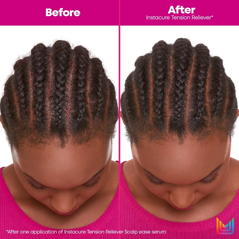 Matrix Instacure Tension Reliever Scalp Treatment 6.8 oz.