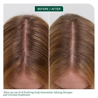 Biolage Scalp Sync Calming Shampoo 13.5 oz.