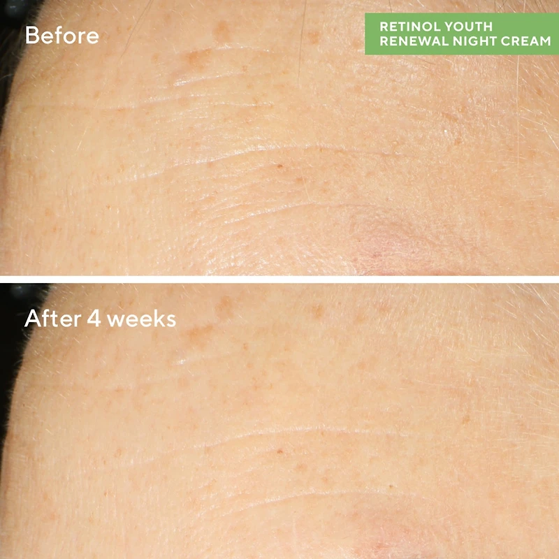 Murad Retinol Youth Renewal Face Serum