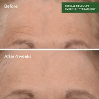 Murad Retinal Resculpting Overnight Treatment Facial Treatment