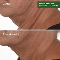 Murad Retinal Resculpting Overnight Treatment Facial Treatment