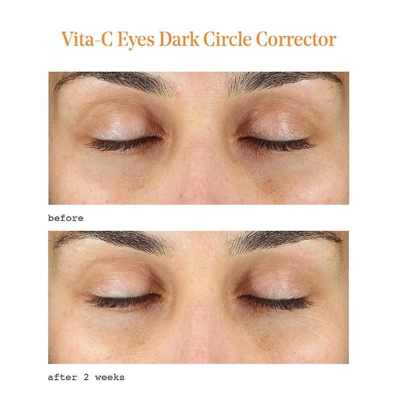 Murad Vita C Dark Circle Corrector Eye Cream