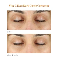 Murad Vita C Dark Circle Corrector Eye Cream