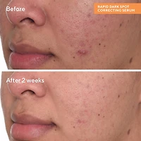 Murad Rapid Dark Spot Correcting Serum Face Serum