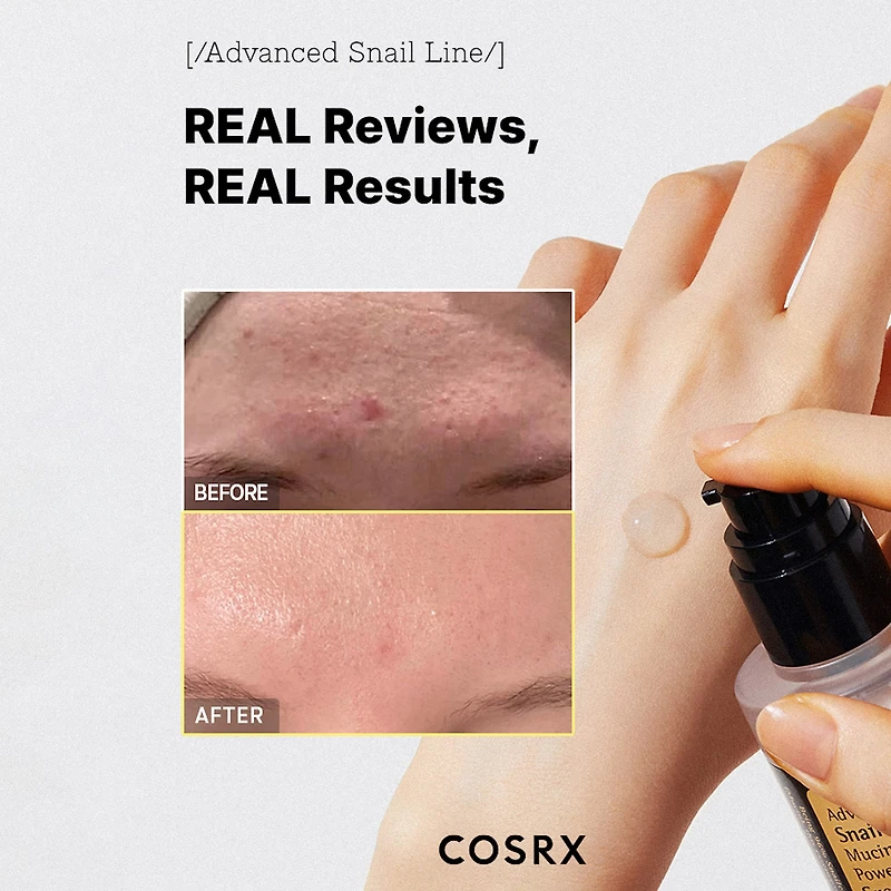 Cosrx Advanced Snail 96 Mucin Power Essence Face Treatment
