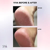 Spa Sciences Viva Advanced Pedicure Foot Smoothing System Callus Remover