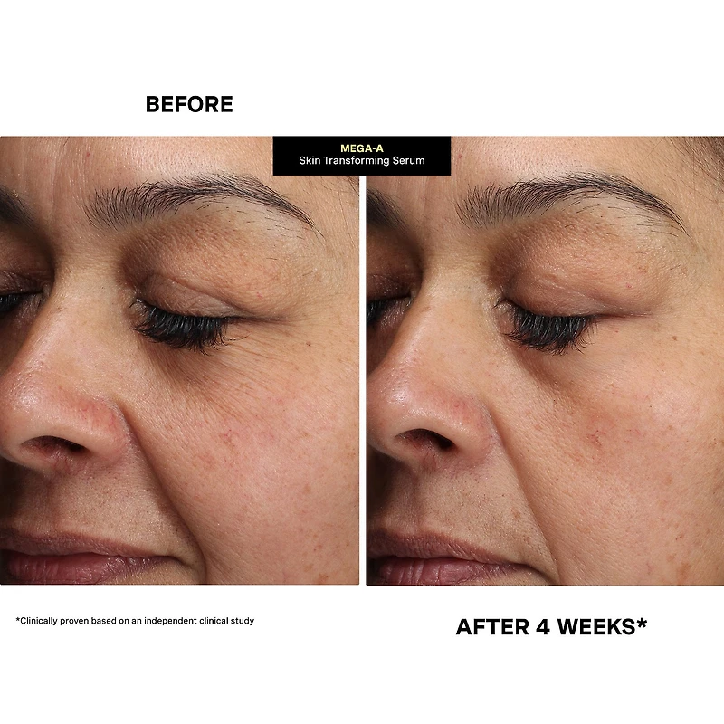 Kate Somerville Mega-A™ Skin Transforming Face Serum