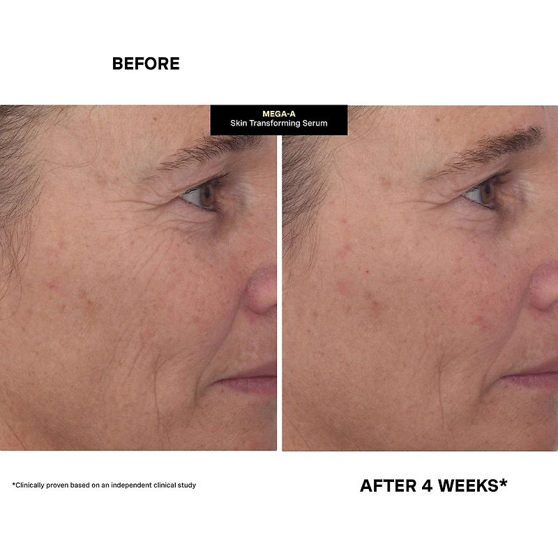 Kate Somerville Mega-A™ Skin Transforming Face Serum