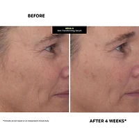 Kate Somerville Mega-A™ Skin Transforming Face Serum