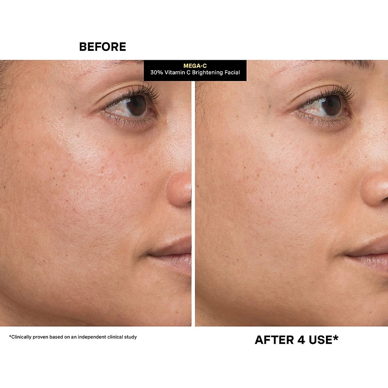 Kate Somerville Mega-C® 30% Vitamin C Brightening Facial