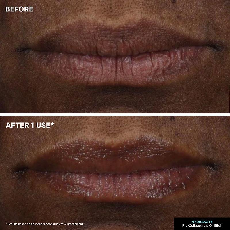 Kate Somerville Hydrakate® Pro-Collagen Lip Oil Elixir