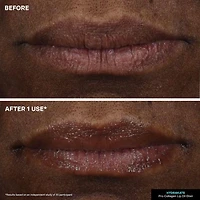 Kate Somerville Hydrakate® Pro-Collagen Lip Oil Elixir