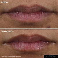 Kate Somerville Hydrakate® Pro-Collagen Lip Oil Elixir