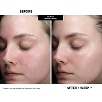 Kate Somerville Delikate® Recovery Serum Face Serum