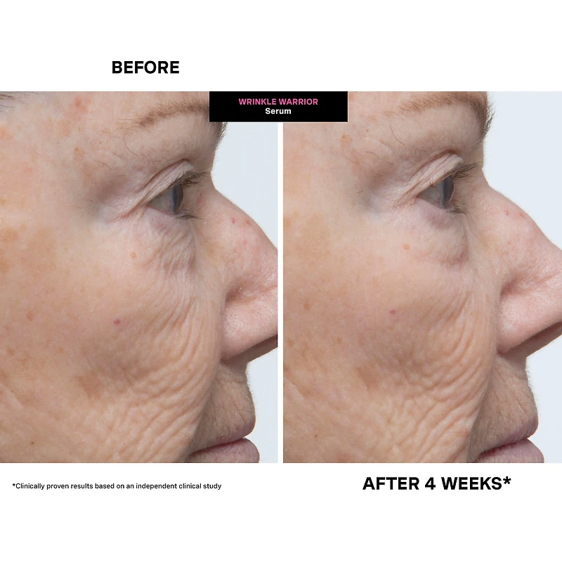 Kate Somerville Wrinkle Warrior® 2-In-1 Plumping Serum + Facial Moisturizer