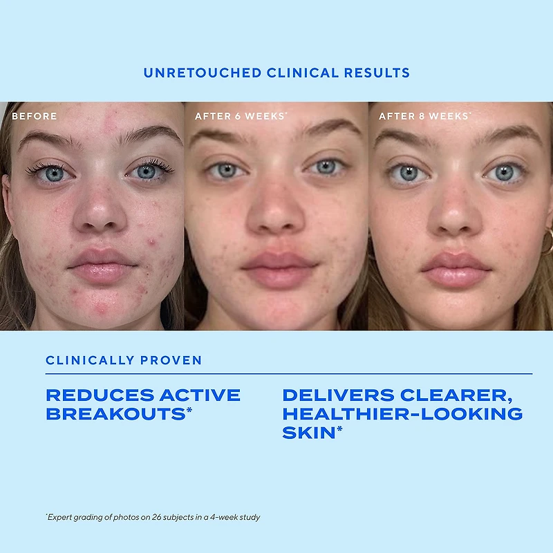 Murad Biome-Balancing Clear & Prevent Acne Treatment Serum