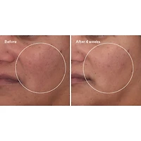 Murad Cellular Hydration Barrier Repair Serum Face Serum