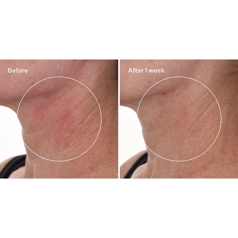 Murad Cellular Hydration Barrier Repair Serum Face Serum