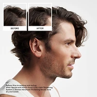 Nioxin® System 2 Scalp Care + Hair Conditioner 33.8 oz.
