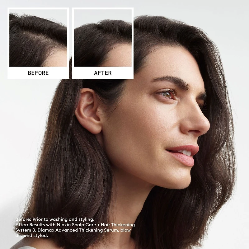 Nioxin® System 3 Scalp Therapy Conditioner - 33.8 oz.