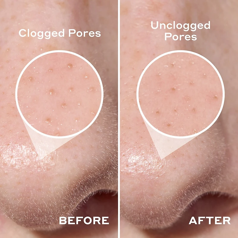 Mario Badescu Pore Strip Cleanser