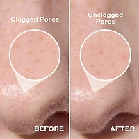 Mario Badescu Pore Strip Cleanser