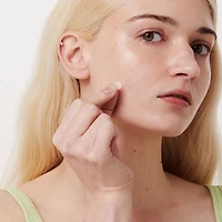 I Dew Care Timeout Blemish Patch Original