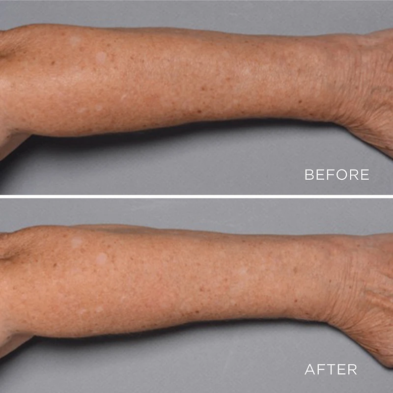 Perricone MD Cold Plasma Plus+ Fragile Skin Therapy (Tube)