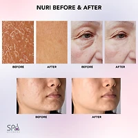 Spa Sciences Nuri Led Thermal Smart Facial Skincare Mask Infuser