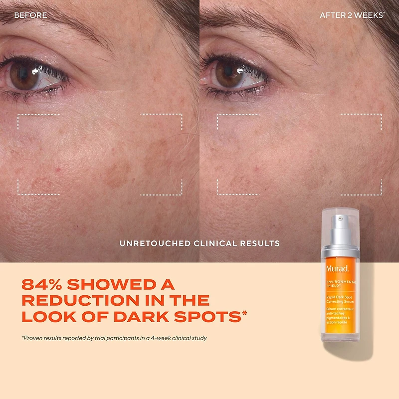 Murad Rapid Dark Spot Correcting Serum Face Serum