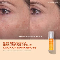Murad Rapid Dark Spot Correcting Serum Face Serum