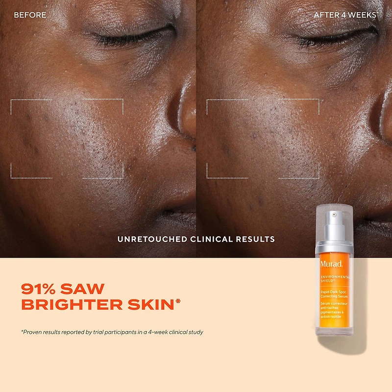 Murad Rapid Dark Spot Correcting Serum Face Serum