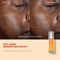 Murad Rapid Dark Spot Correcting Serum Face Serum