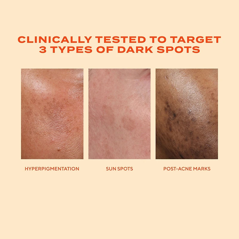 Murad Rapid Dark Spot Correcting Serum Face Serum