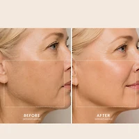 Spa Sciences Sima Sonic Facial Exfoliation And Hair Removal System