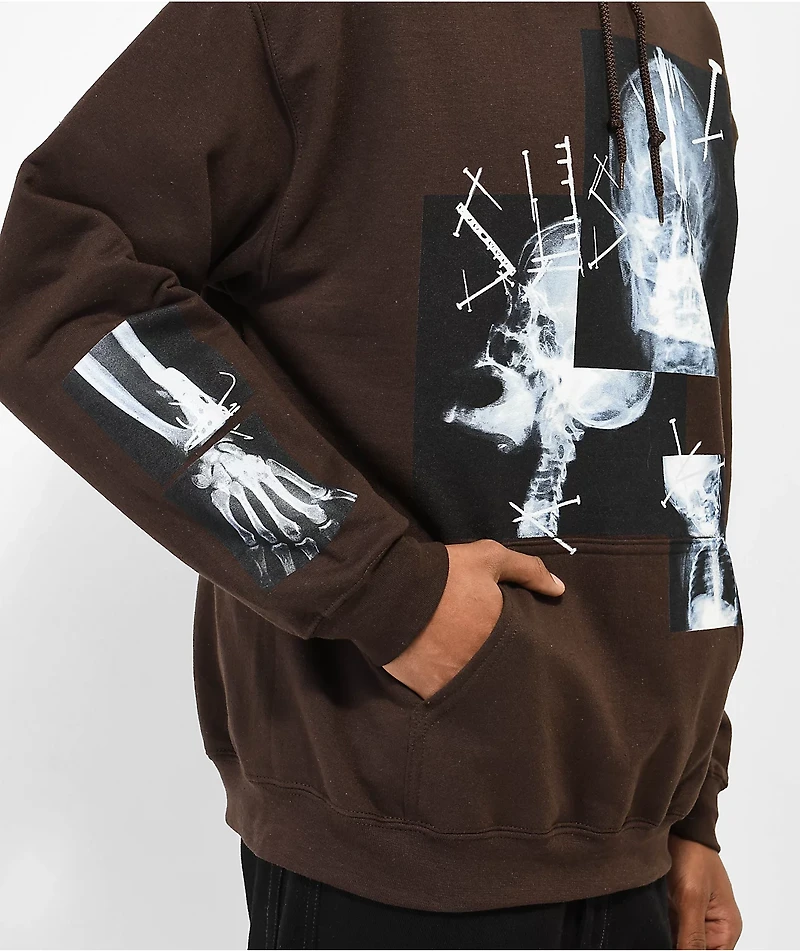 SUS BOY X-Ray Dark Brown Hoodie