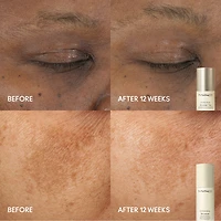 Hyper Real™ Radiant Face + Eye Kit ($163 Value)