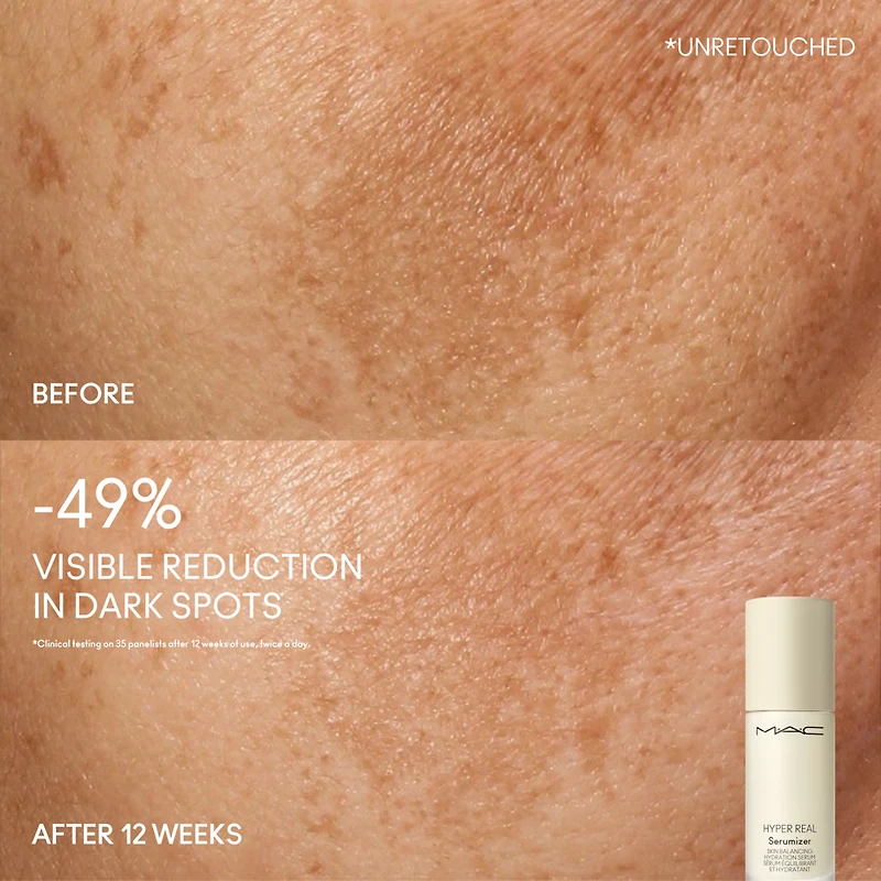 Hyper Real Serumizer™ Skin Balancing Hydration Serum
