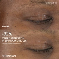 Hyper Real Serumizer™ Eye 360° Bright Eye Treatment