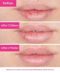 Grande Cosmetics GrandePOUT Plumping Lip Mask - Berry Mojito