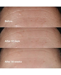 Clinique Smart Clinical Repair Wrinkle Correcting Serum Mini, 0.34 oz.