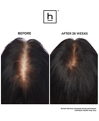 HairMax Laserband 41 Comfortflex