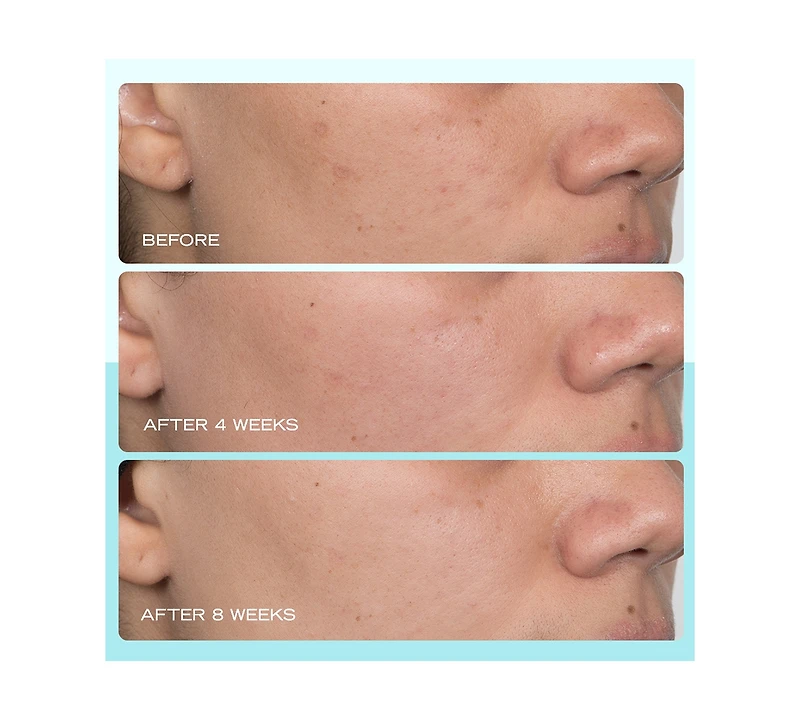 First Aid Beauty Dark Spot Serum With Niacinamide, 1 oz.