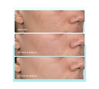 First Aid Beauty Dark Spot Serum With Niacinamide, 1 oz.