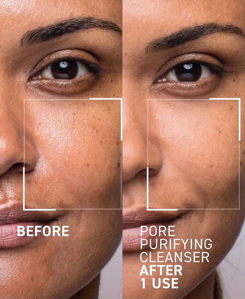 dr. brandt Pores No More Pore Purifying Cleanser