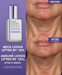 Estee Lauder Perfectionist Pro Rapid Firm Lift Serum
