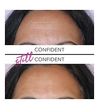 Undereye Firming Gel